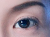 Natural ~6mm Asian Double Eyelid with very mild inside epicanthal fold. Dr. Miranda performs the DST technique double eyelid surgery.